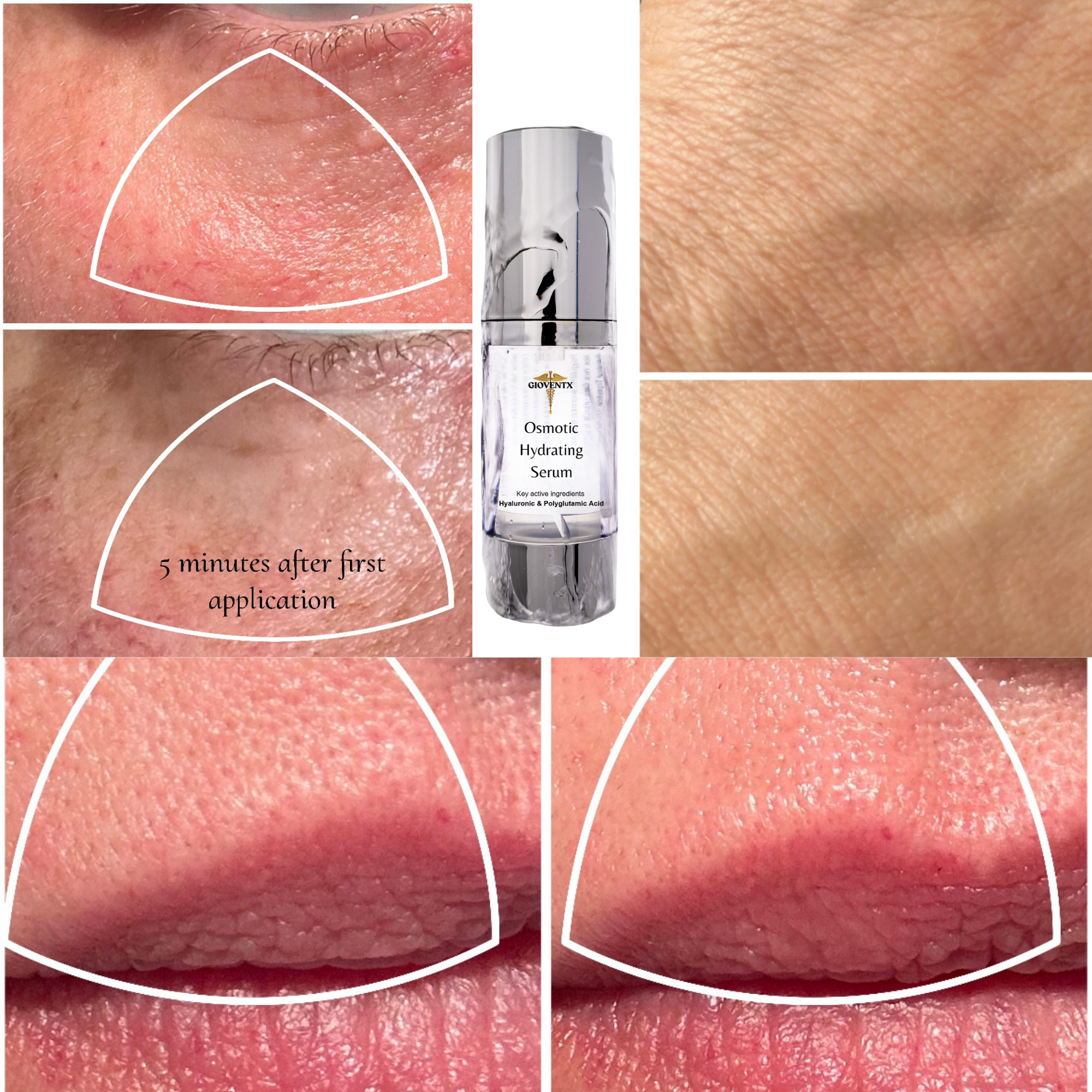 Osmotic Hydrating Serum-Hyaluronic & Polyglutamic Acid